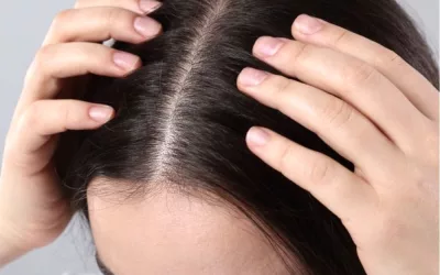 I have very weak hair, what kind of treatment can I do?